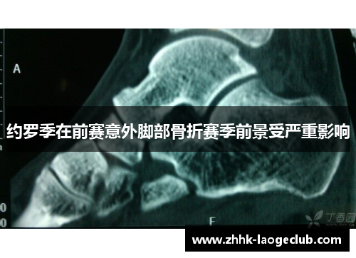 约罗季在前赛意外脚部骨折赛季前景受严重影响 约罗季在前赛意外脚部骨折赛季前景受严重影响